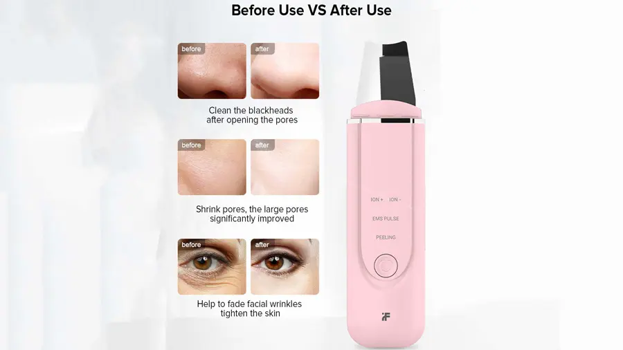 مقایسه حالت های قبل و بعد از استفاده پاک کننده آلتراسونیک صورت شیائومی Xiaomi InFace Ultrasonic Ion Cleansing MS7100