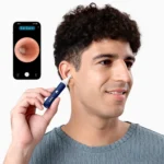 گوش پاک کن هوشمند بیبرد مدل Bebird EarSight Plus - تصویر 7