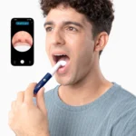 گوش پاک کن هوشمند بیبرد مدل Bebird EarSight Plus - تصویر 8